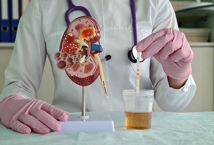 best kidney specialists